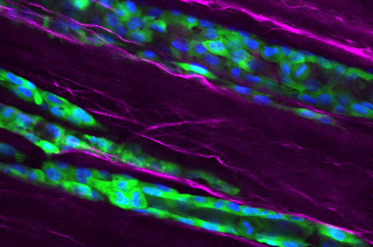 Spread of turbulent cancer cells