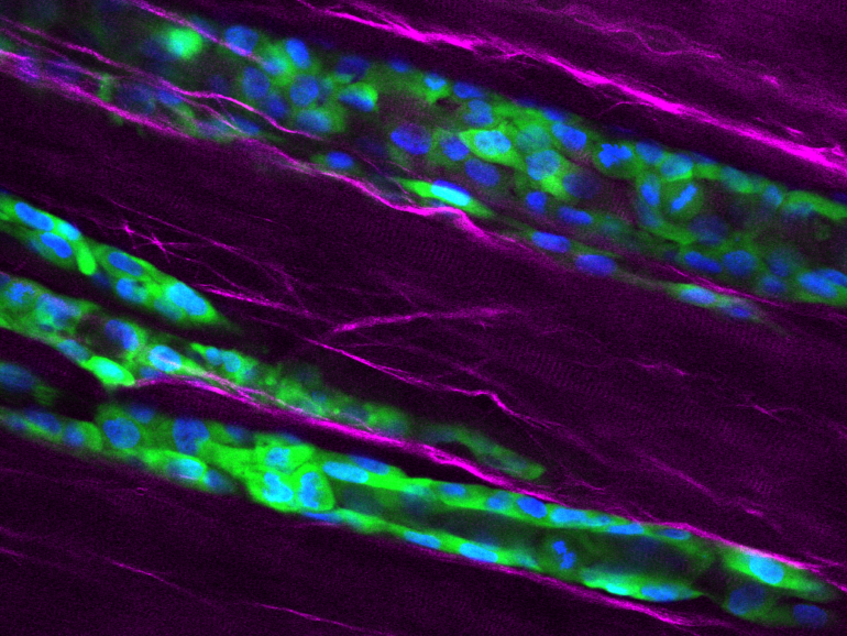 Spread of turbulent cancer cells